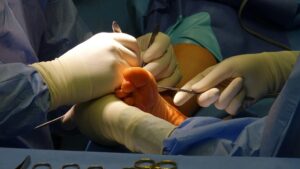 How Testosterone Therapy Affects Men Who Are Preparing for Major Surgery