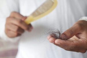 The Truth About Testosterone Therapy and Hair Loss Men Need to Hear